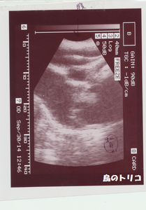 3 くららちゃん卵巣嚢胞のエコー画像 001.png