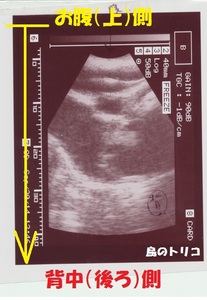 4 くららちゃん卵巣嚢胞のエコー画像 002.jpg