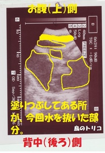6 くららちゃん卵巣嚢胞のエコー画像 004.jpg